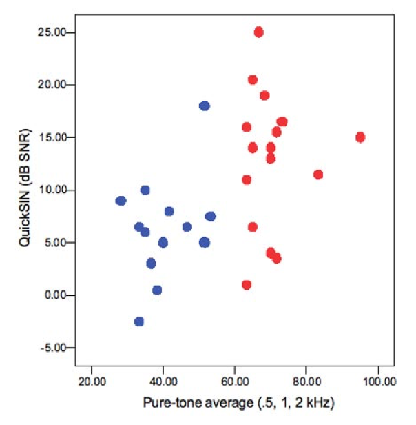 Speech understanding in noise. Mild to moderate versus severe hearing loss