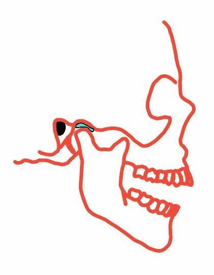 The mandible pivots and glides at the TMJ