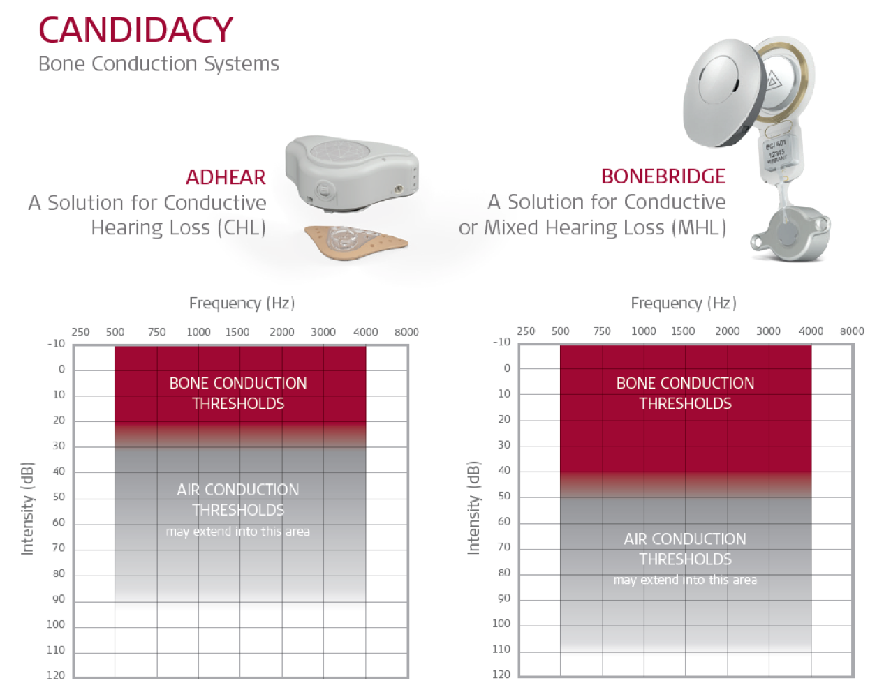 ADHEAR and BONEBRIDGE candidacy audiograms