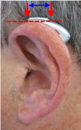 Optimal placement of the hearing aid behind the ear where the front and rear microphones are sitting close to the horizontal plane