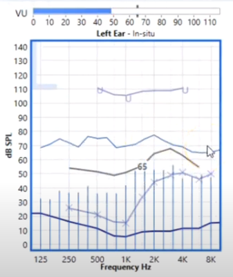 Example of speech mapping