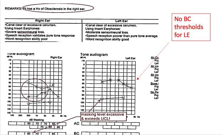 Testing and interpreting error 1