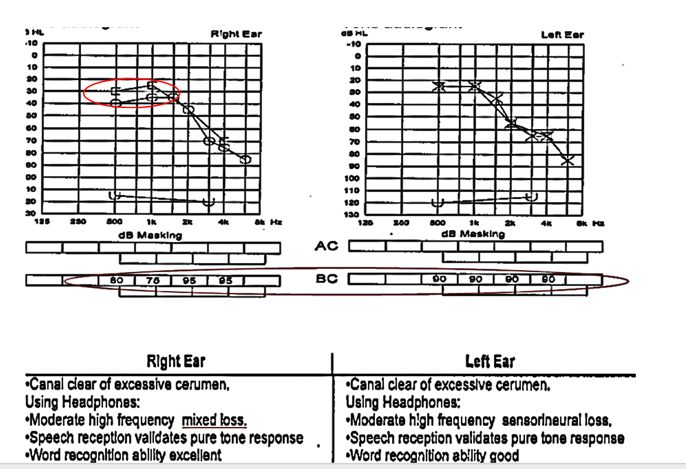 Testing and interpreting error 2