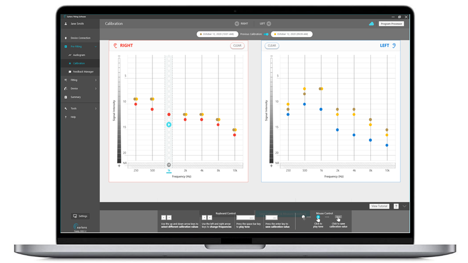 Earlens Fidelity fitting software calibration screen