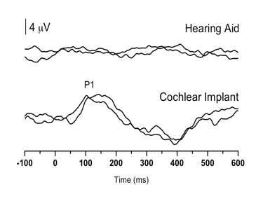 P! CAEP waveforms as described in Figure 2 caption.