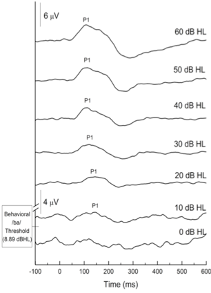 CAEP waveforms as described in Figure 3 caption