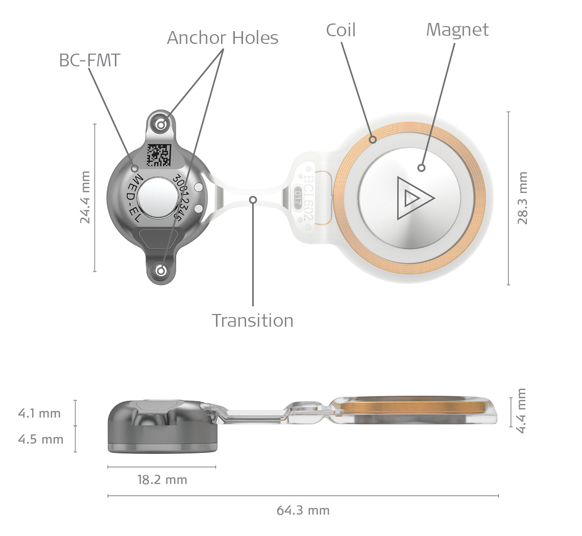 BCI 602 measurements and individual parts