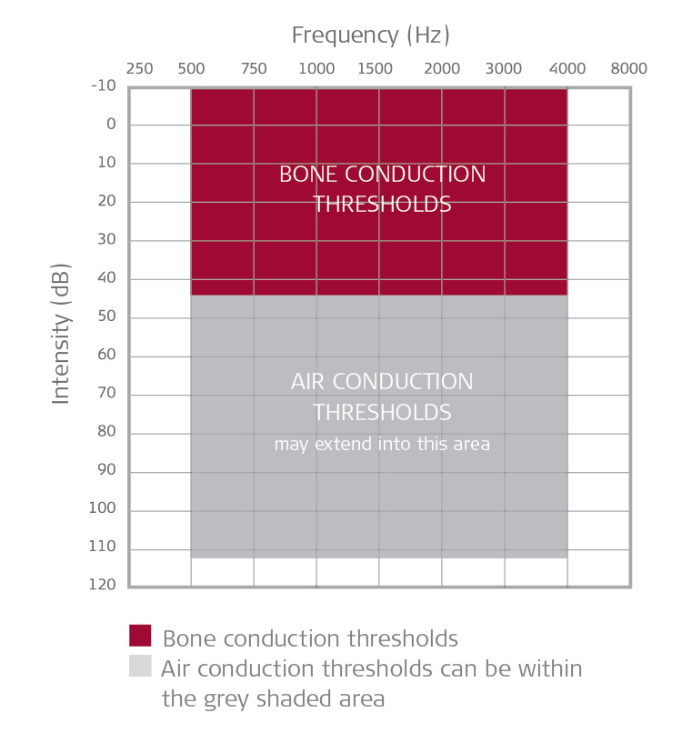 Candidacy bone and air conduction thresholds for conductive and mixed hearing loss