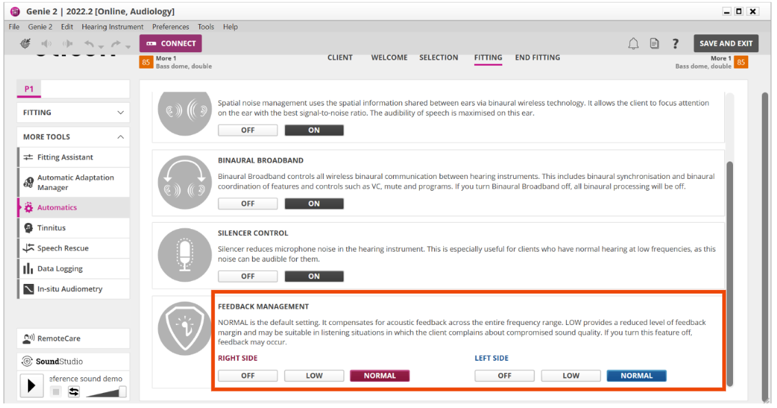 Oticon feedback cancellation screen. 