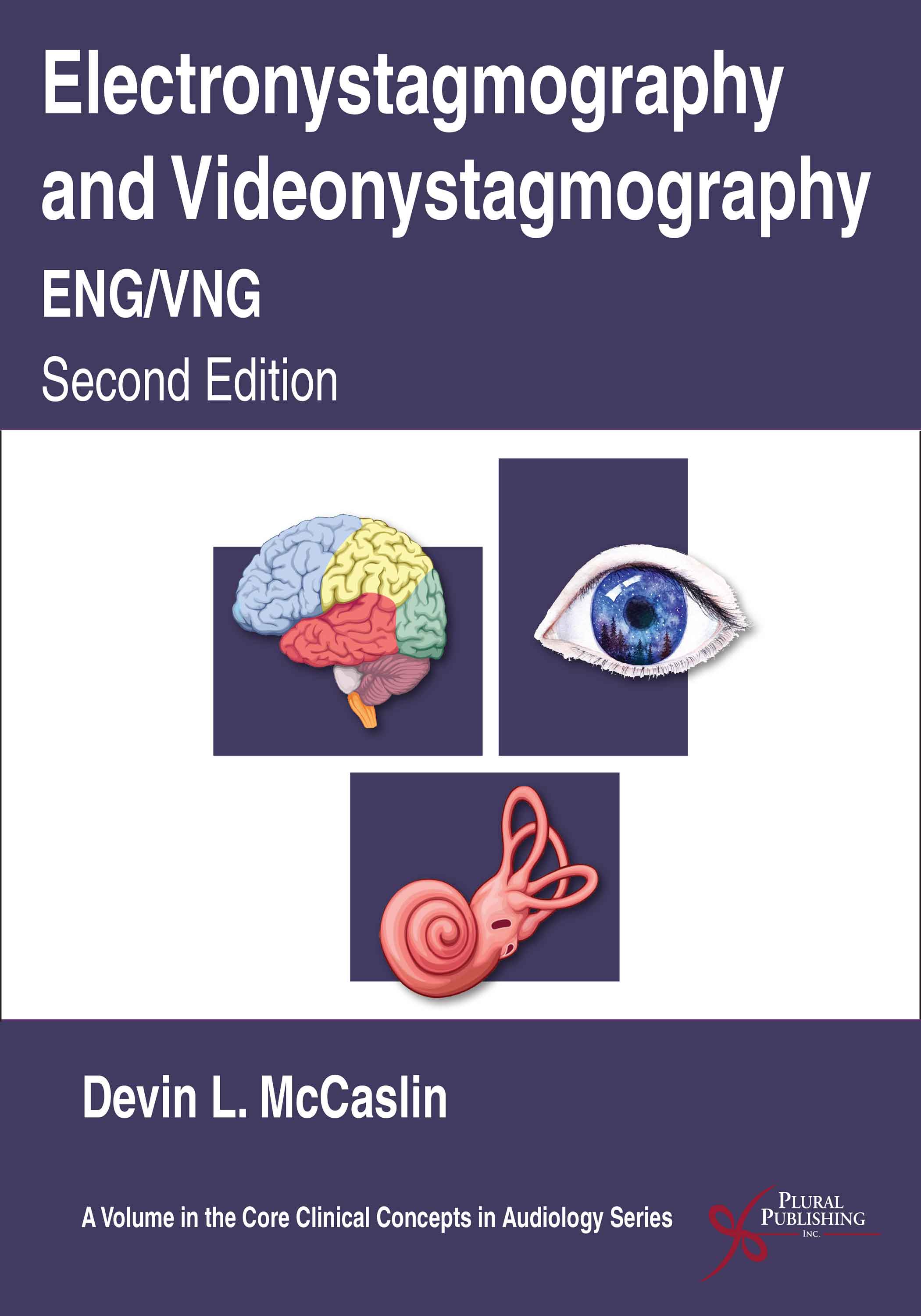 Electronystagmography/Videonystagmography (ENG/VNG), Second Edition