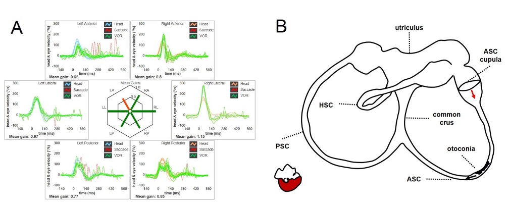 Figure 29195