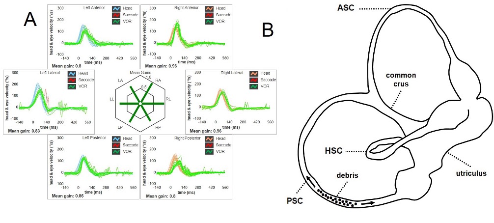 Figure 3 29195