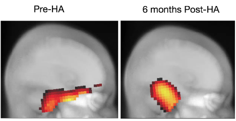 Figure 1 29269