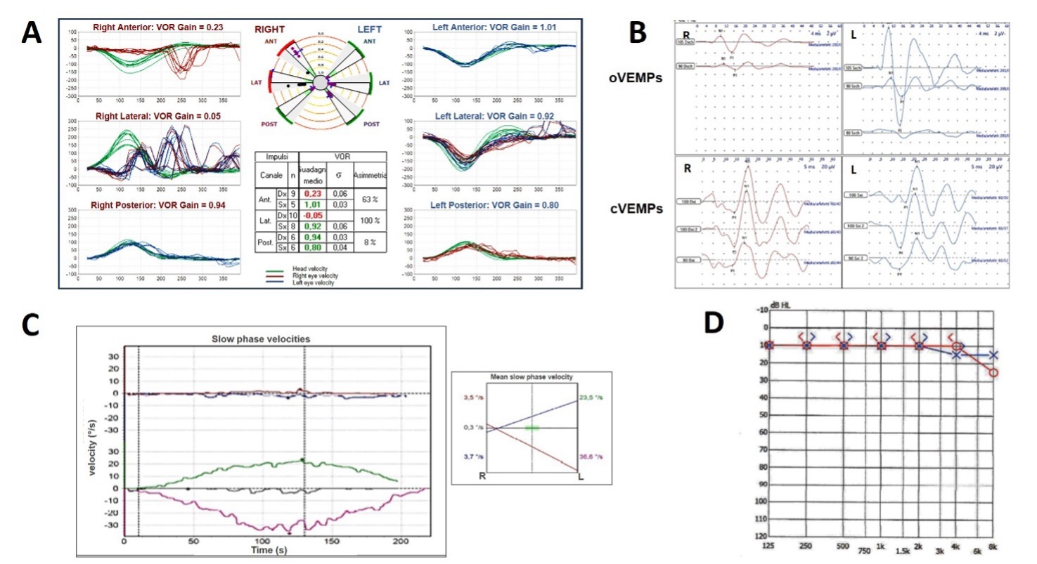 Figure 3 29330