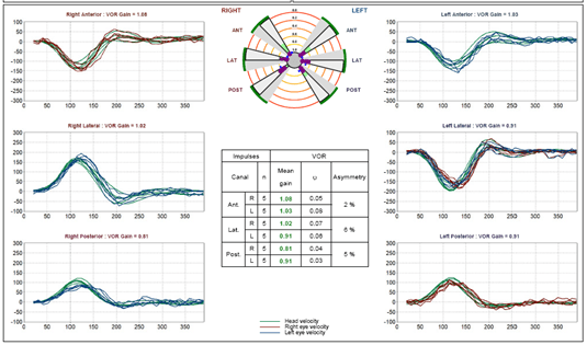 Figure 2 29359