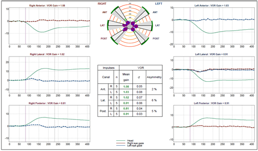 Figure 3 29359