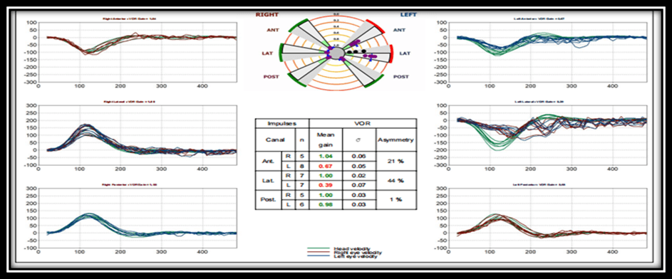 Figure 4 29359