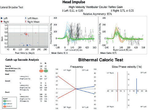 Figure 5 - ATE Inventis