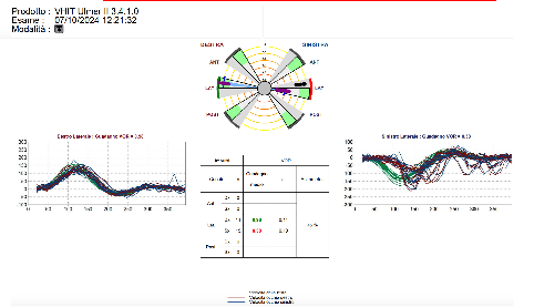 vHIT results in ER a 14month old male