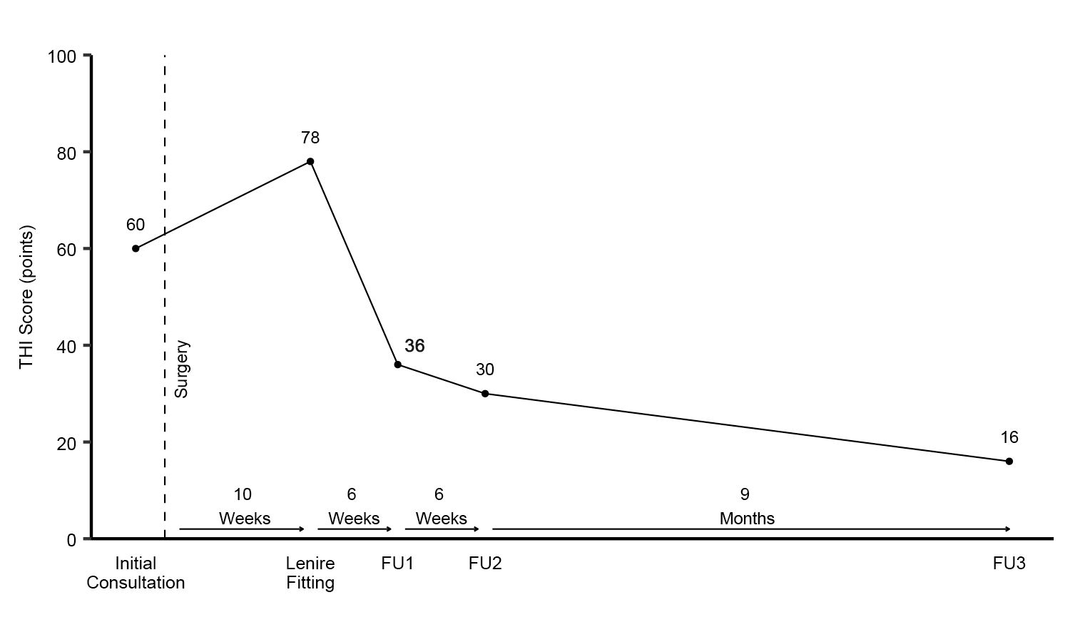 Tinnitus Handicap Inventory Before, During, and After Treatment with Lenire