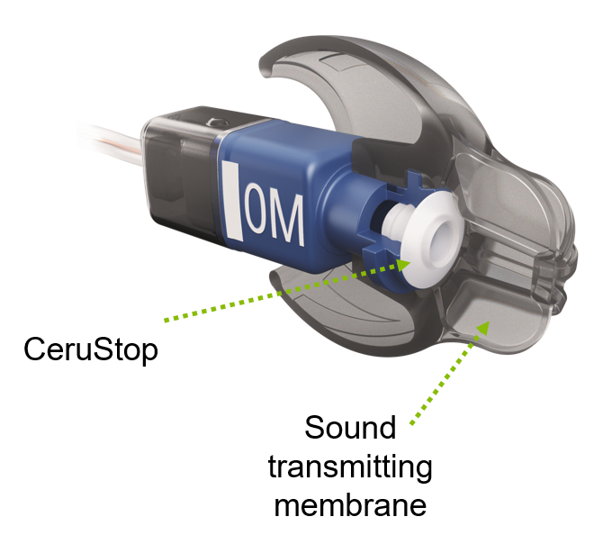 EasyGuard cross section