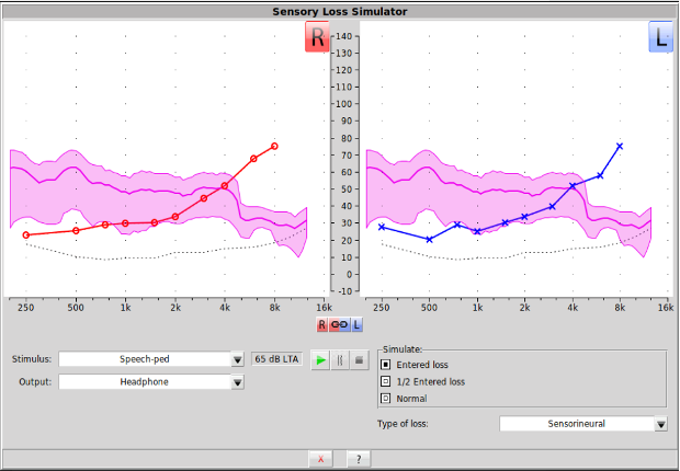 A counseling screen displaying hearing thresholds (X and O) overlaying pink-shaded regions representing simulated audibility for the patient's family.