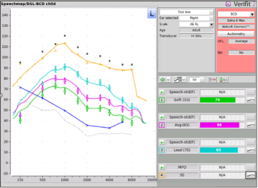A Speechmap FLogram showing soft (55), average (65), and loud (75) speech curves matched to DSL-BCD targets in force level.